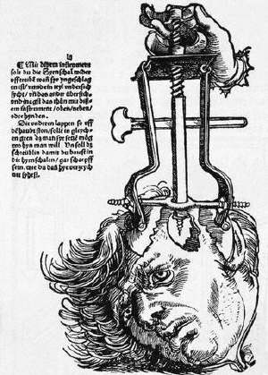 The Trepanation of the Skull